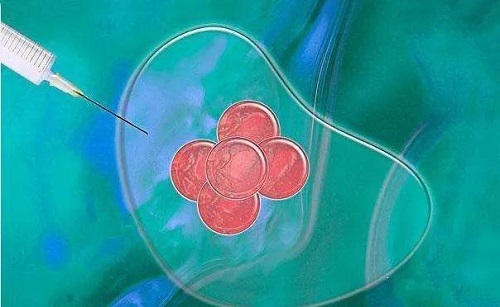 試管已生的總結(jié)，要注意什么？
